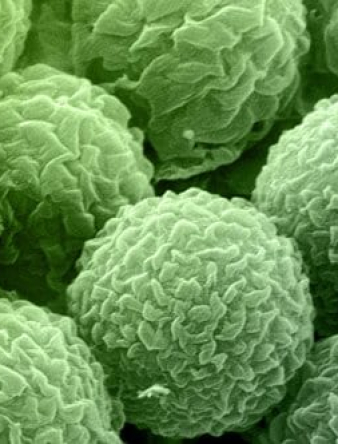 How, When and Where Mold Occurs