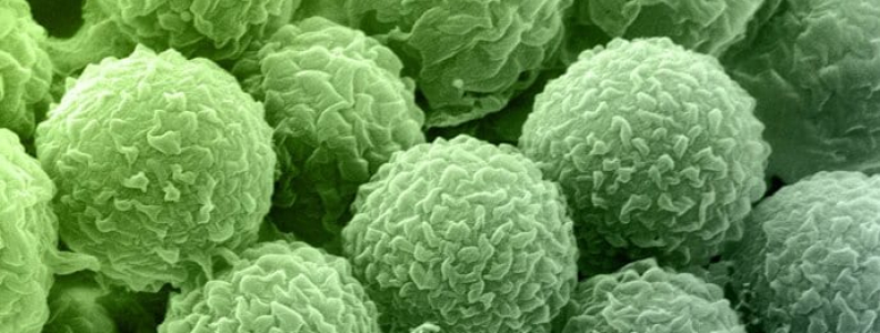 How, When and Where Mold Occurs How, When and Where Mold Occurs